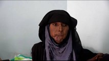 Yemen's cancer patients suffer as clinics are closing