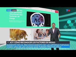 Con Bienestar: Cómo reconocer las causas de un ACV