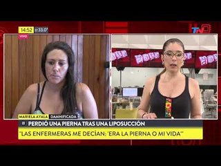 Perdió una pierna tras una liposucción