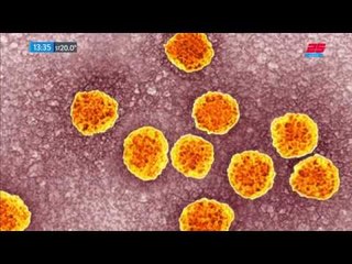 Con bienestar: Hepatitis C, tiene cura y pocos lo saben