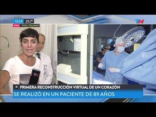 Priemera reconstrucción virtual de un corazón