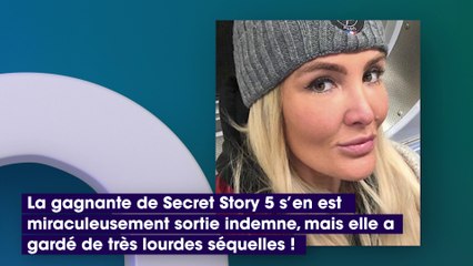 Marie Garet défigurée après un accident : "J'aurais préféré être morte belle"