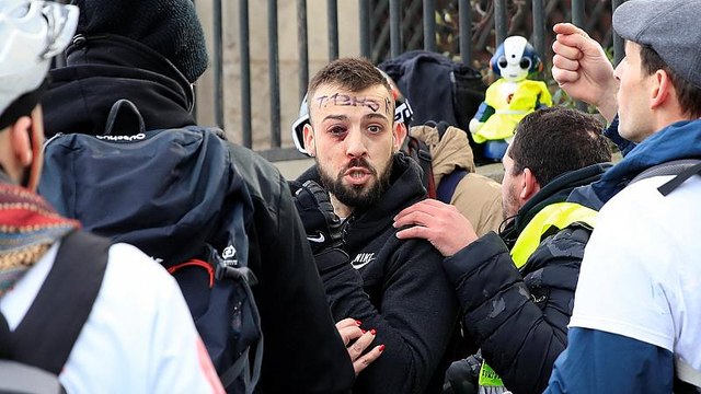 شاهد: إصابة أحد محتجي السترات الصفراء في احتجاجات الأسبوع الثالث عشر