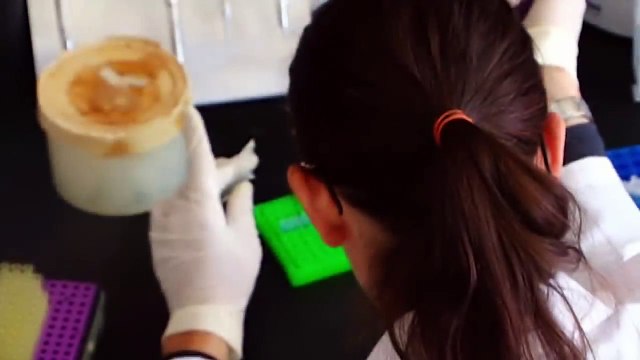 The Woman Whose Legs Turned Black - Cryoglobulinemia (Medical Documentary)