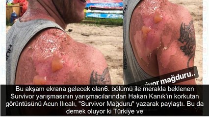 Acun Ilıcalı Hakan Kanık'ın Survivor'daki korkutan görüntüsünü paylaştı