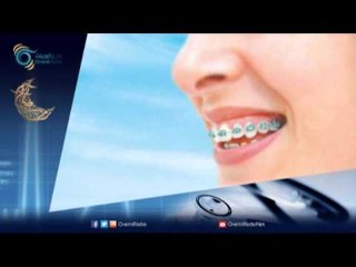 تقويم الاسنان | أورينت كلينيك