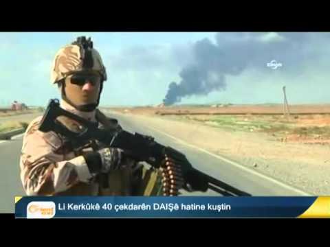 Aloziyên Başûr: 87 kes birîndar bûn