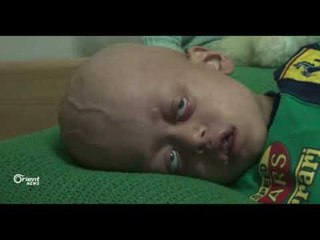 ناشطون يطلقون حملة الأسد يحاصر الغوطة