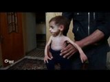 أطفال الغوطة ضحايا حصار الأسد وملشياته
