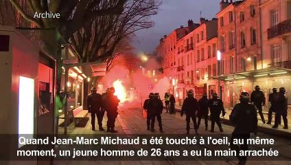 Gilets Jaunes:Jim a perdu un oeil, mais pas l'envie de continuer