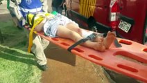 Menina tem lesão na perna após cair em bueiro