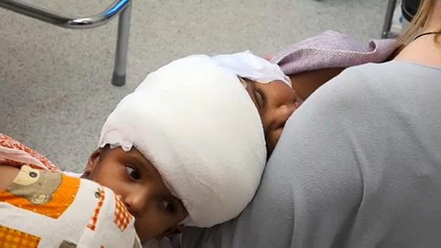 Ουγγαρία: Ελπίδες για τα σιαμαία από το Μπανγκλαντές