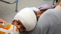 Macar doktorlar başı yapışık ikiz bebeklerin ameliyatını başarıyla tamamladı