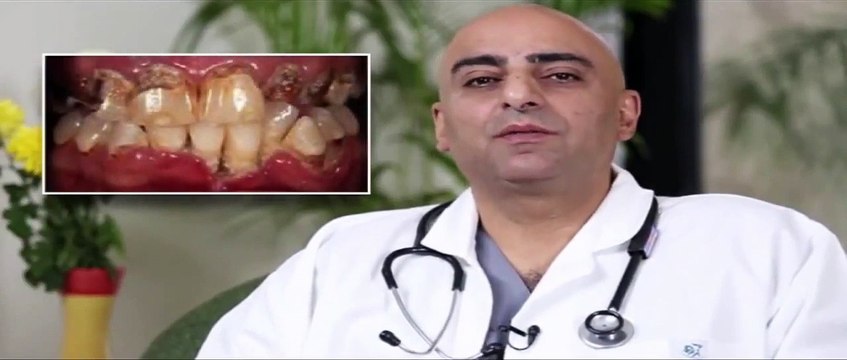 Early Signs of Oral Cancer - Oral Cancer Symptoms Explained By Dr. Sameer