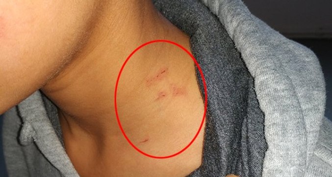 İstanbul'da Kadın Öğretmen Dehşeti! 13 Yaşındaki Öğrencinin Boğazını Sıkıp Tekmeledi