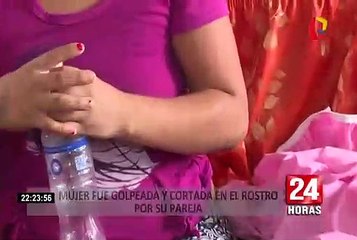 Puente Piedra: autoridades brindarán seguridad a mujer golpeada por su pareja