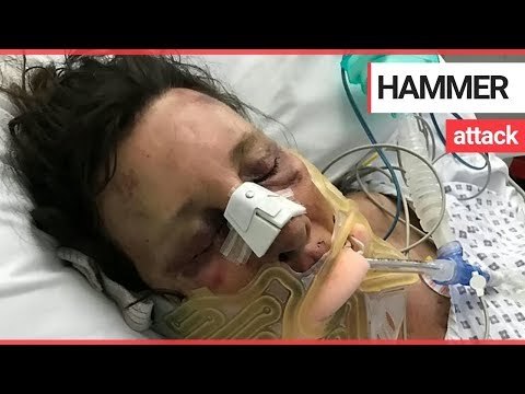 Pensioner feared she would die after bodybuilder hits her with hammer | SWNS TV