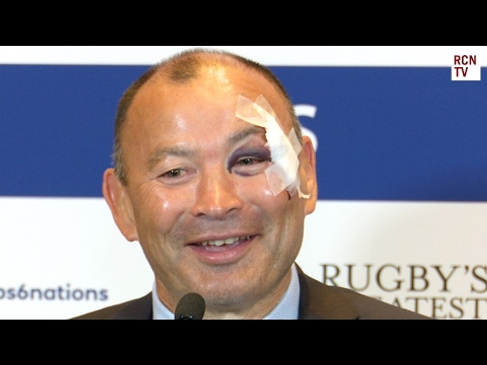 Eddie Jones Interview Embarrassing Bathroom Accident