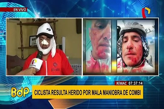 Ciclista denunció atropello por combi en avenida Túpac Amaru