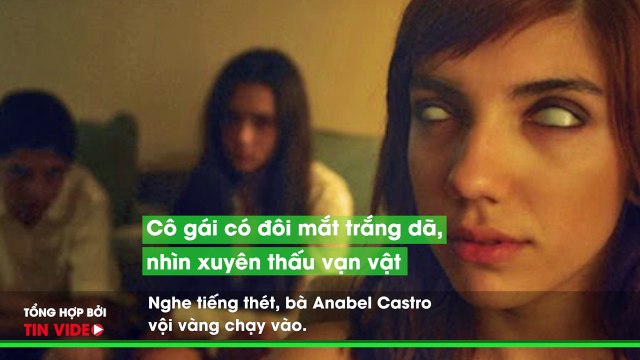 MS Bí ẩn những đôi mắt kì lạ như bị nguyền rủa, đến khoa học cũng phải đau đầu