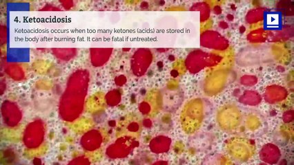 7 Dangers of the Keto Diet