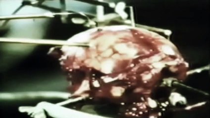 Dr. Giordano: The Brain is the Battlefield  pt2of2