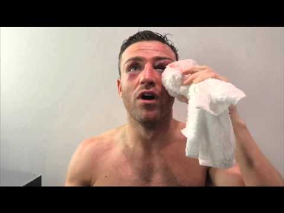 'IF IM GOING OUT IM GOING OUT SWINGING!! -MATTHEW MACKLIN REACTS TO HIS POINTS WIN OVER BRIAN ROSE