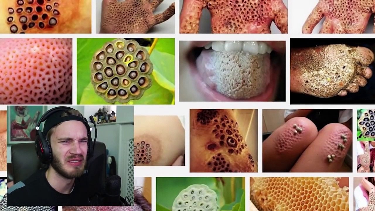 10 Things You Should Never Google (WARNING GROSS)