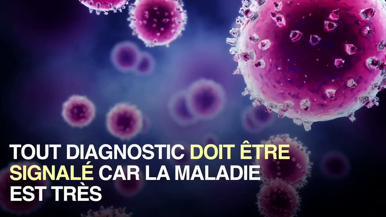 Légionellose  : la région Rhône-Alpes en alerte_
