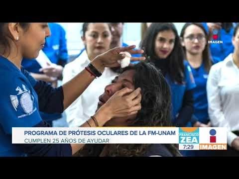 UNAM beneficia a más de 6 mil personas con prótesis oculares | Noticias con Francisco Zea