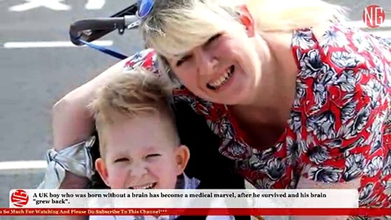 Medical Marvel! Born Without Brain, Noah Is Much Alive!