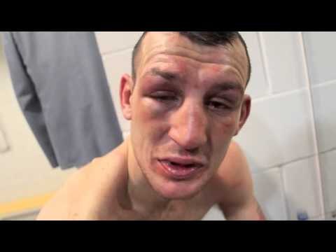 DERRY MATHEWS POST-FIGHT INTERVIEW FOR iFILM LONDON / MATHEWS v CROLLA 2