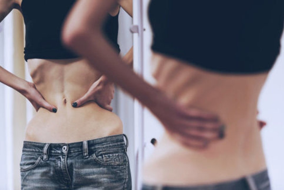 Anorexie : erste Anzeichen erkennen