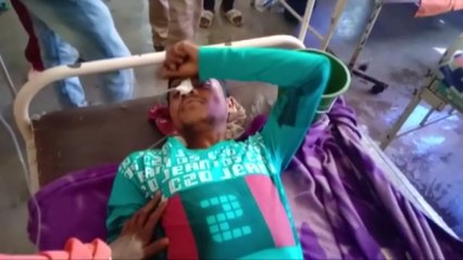 인도 또 '밀주 참사'..."근로자 84명 밀주 마시고 숨져" / YTN