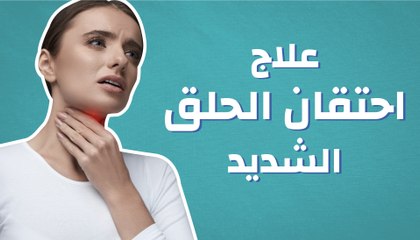 علاج احتقان الحلق الشديد