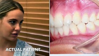 Patient's Review after Invisalign Treatment at Healthy Smiles