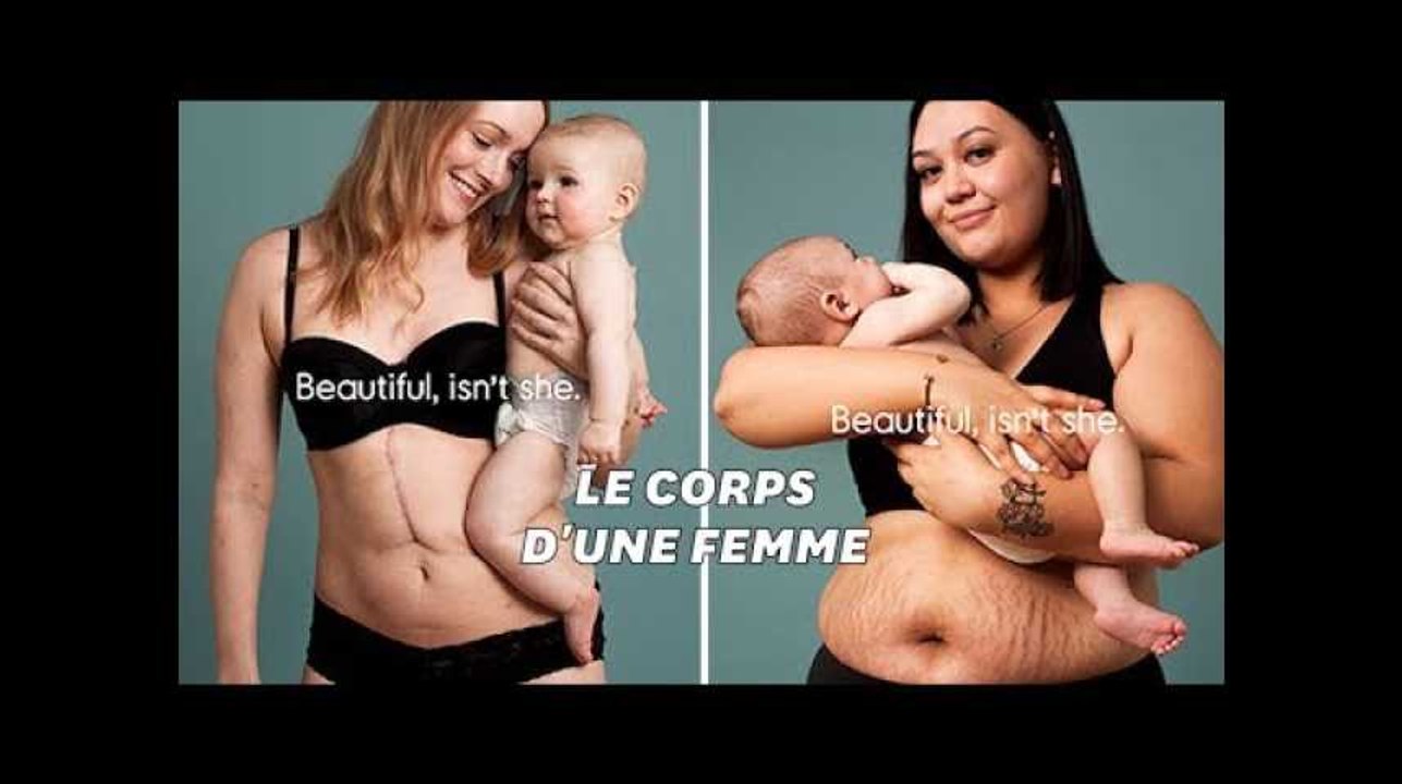 Ces mamans affichent fièrement leurs corps après leur accouchement