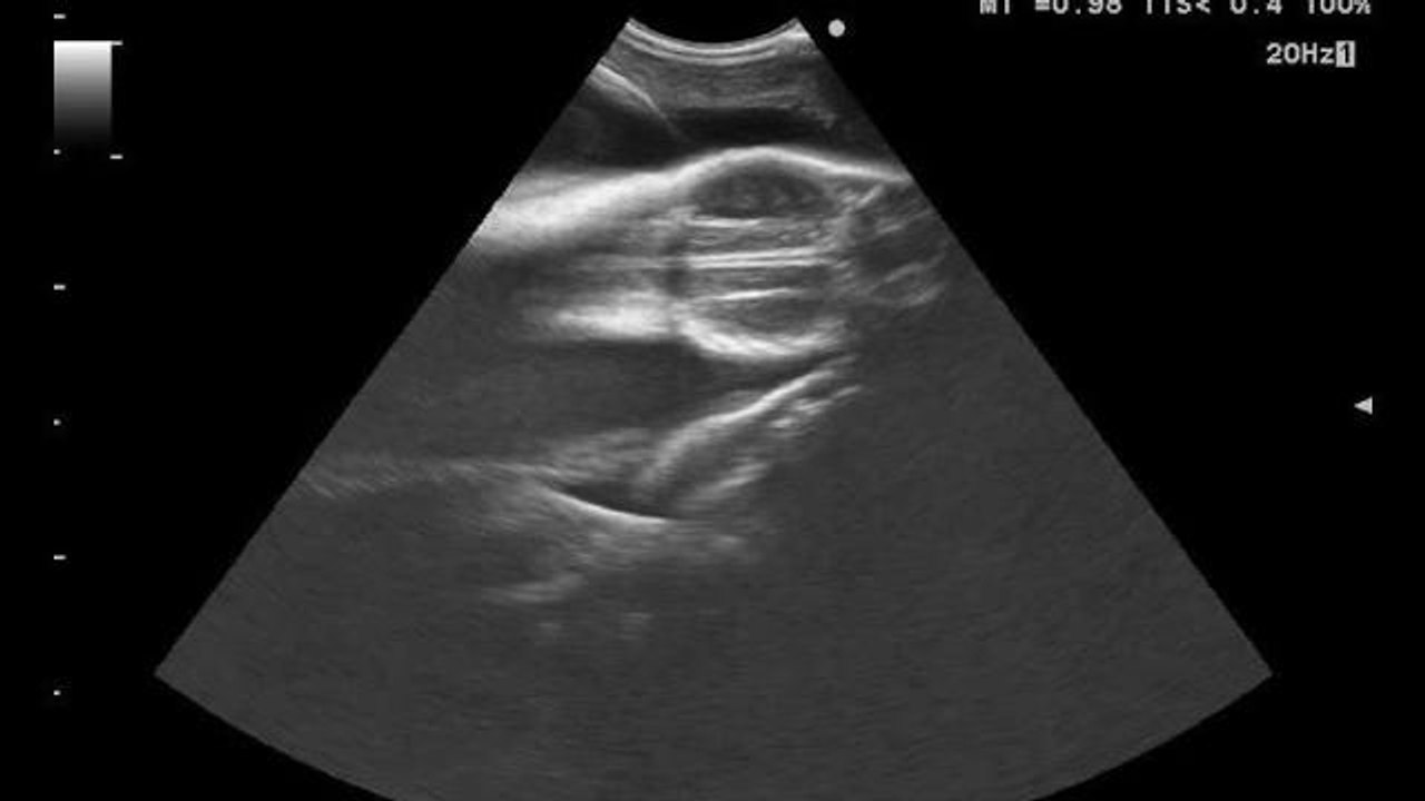 Echographie d'une femelle  requin nourrice fauve