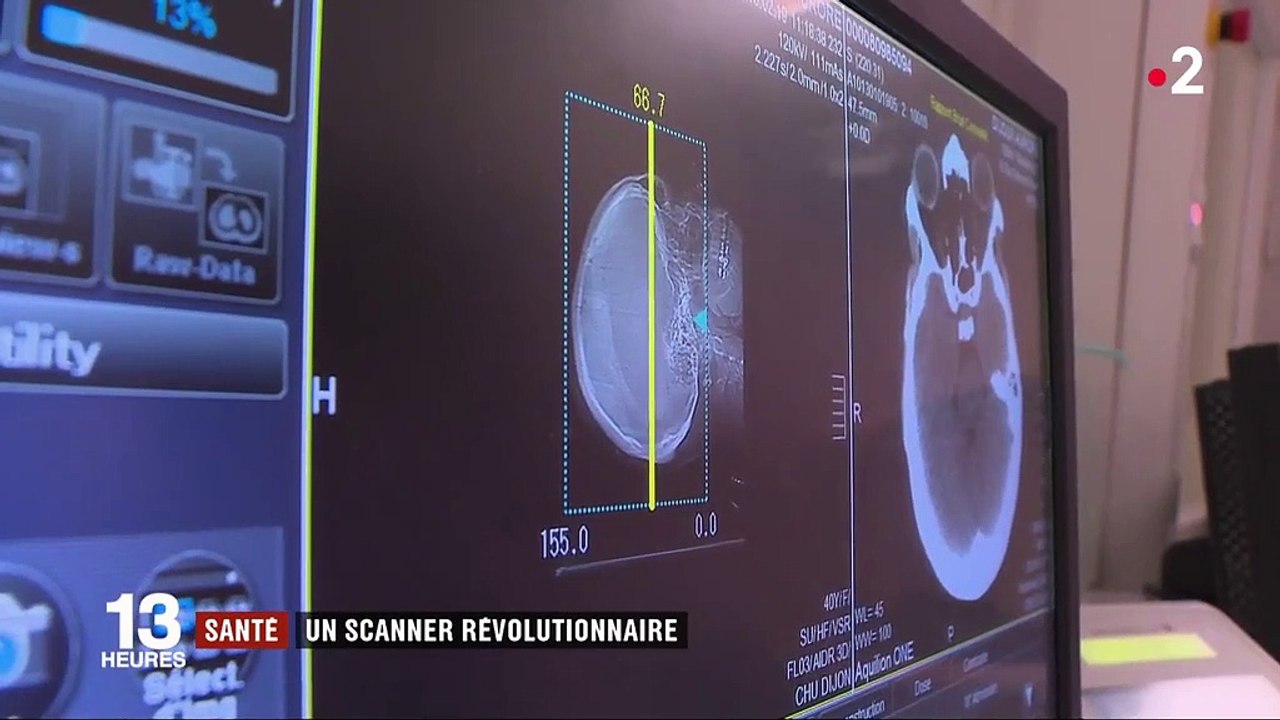 Santé : un scanner révolutionnaire