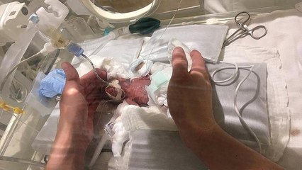 Japan: 268 Gramm - weltweit kleinster Junge überlebt