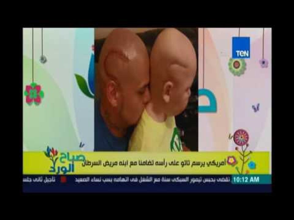 صباح الورد | - امريكي يرسم تاتو علي رأسه تضامنا...