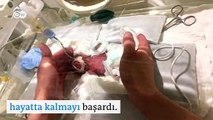 268 gramlık bebek artık hastaneden taburcu oldu