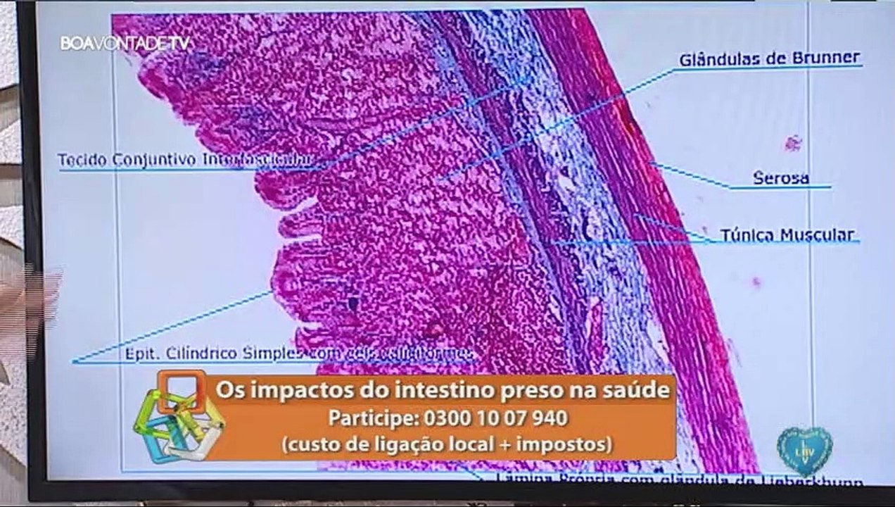 Os impactos do intestino preso na saúde