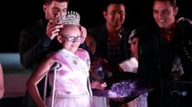 Pageant For Child Cancer Patients Helps Boost Self-Esteem