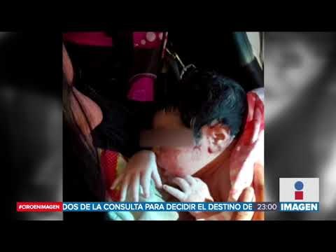 Médicos muestran creatividad al intentar salvar vidas | Noticias con Ciro Gómez Leyva