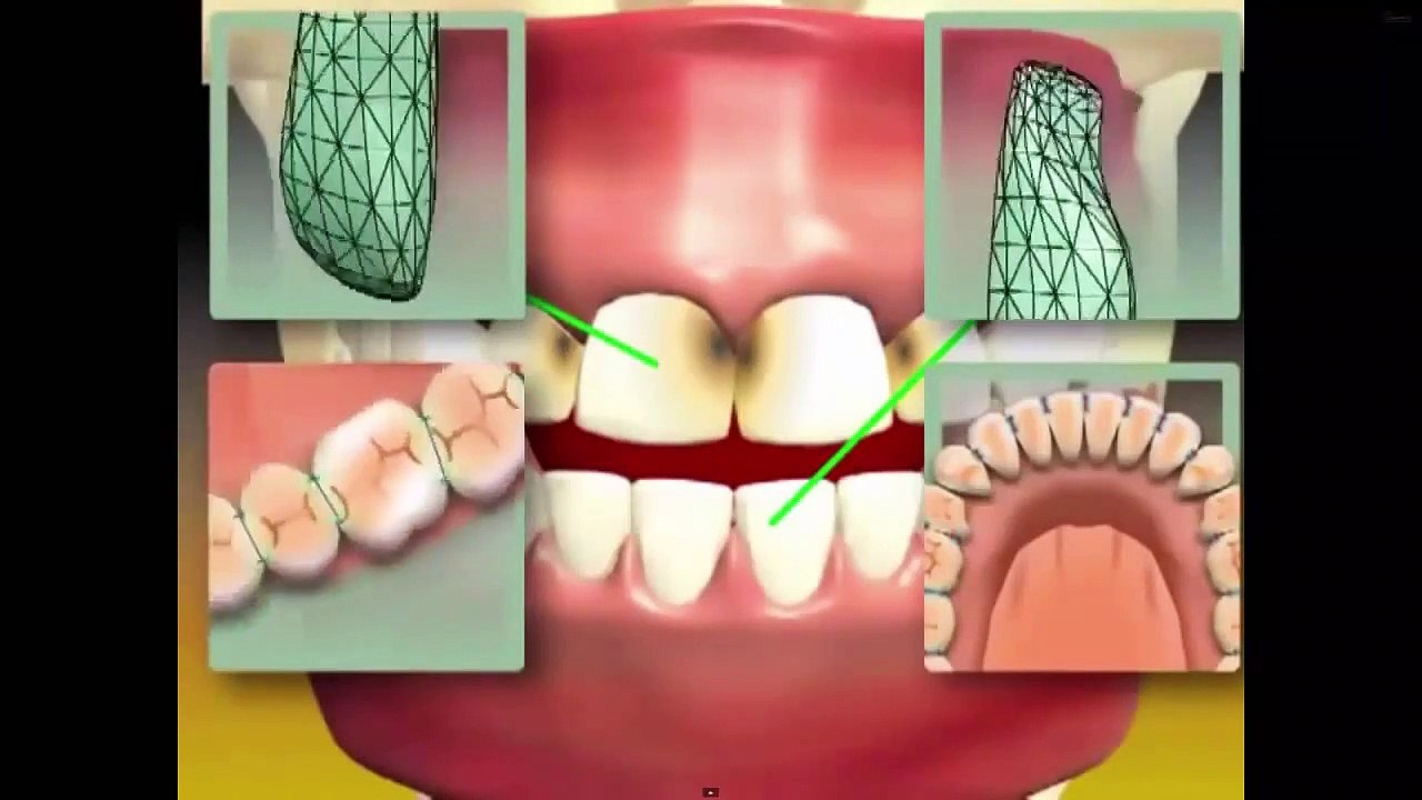 Infos zum Erstgespräch bei Denta Beaute