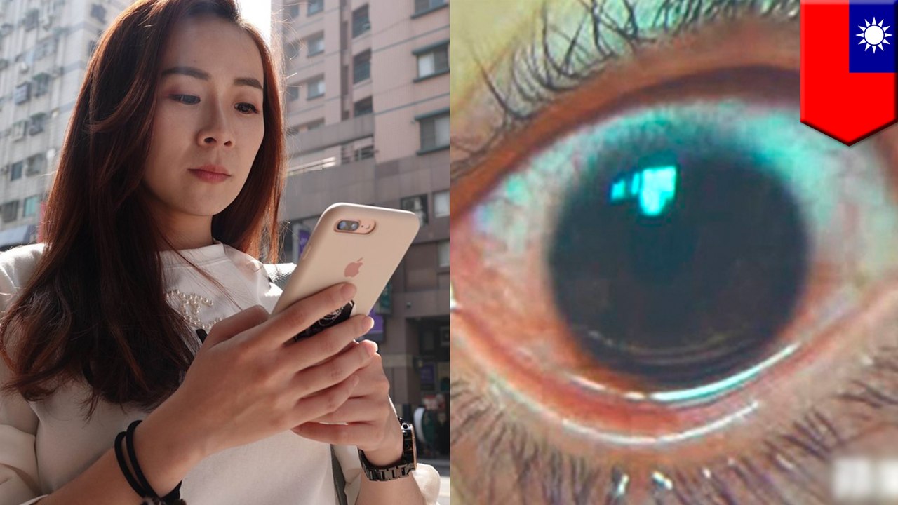 スマホ画面の明るさを最大にして見続けた女性 角膜に500の穴 - トモニュース