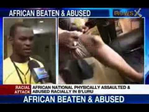 News X: African National physically assaulted racially in Bengaluru