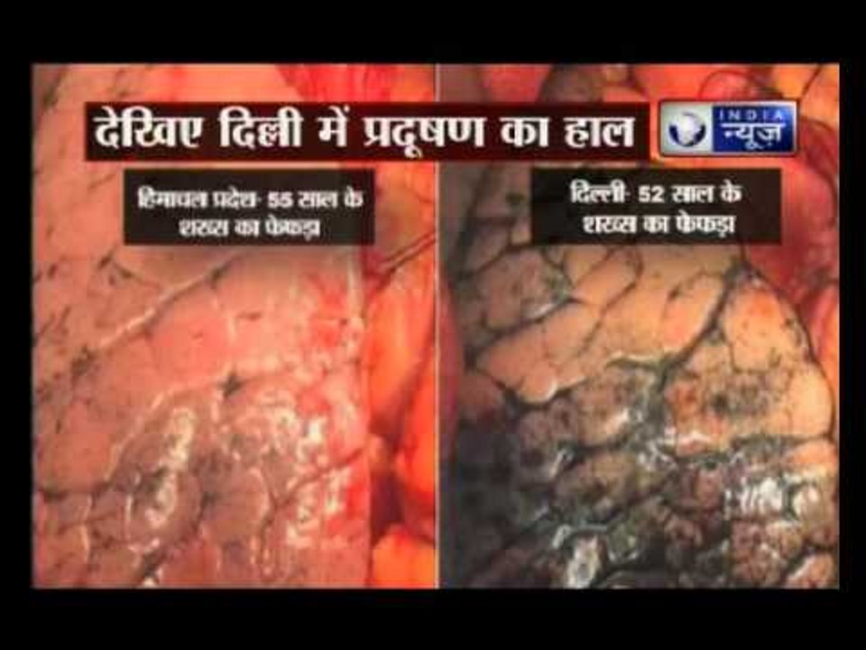 Pollution driven city: Delhi