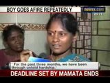NewsX: Rare medical condition sets Chennai baby boy afire repeatedly